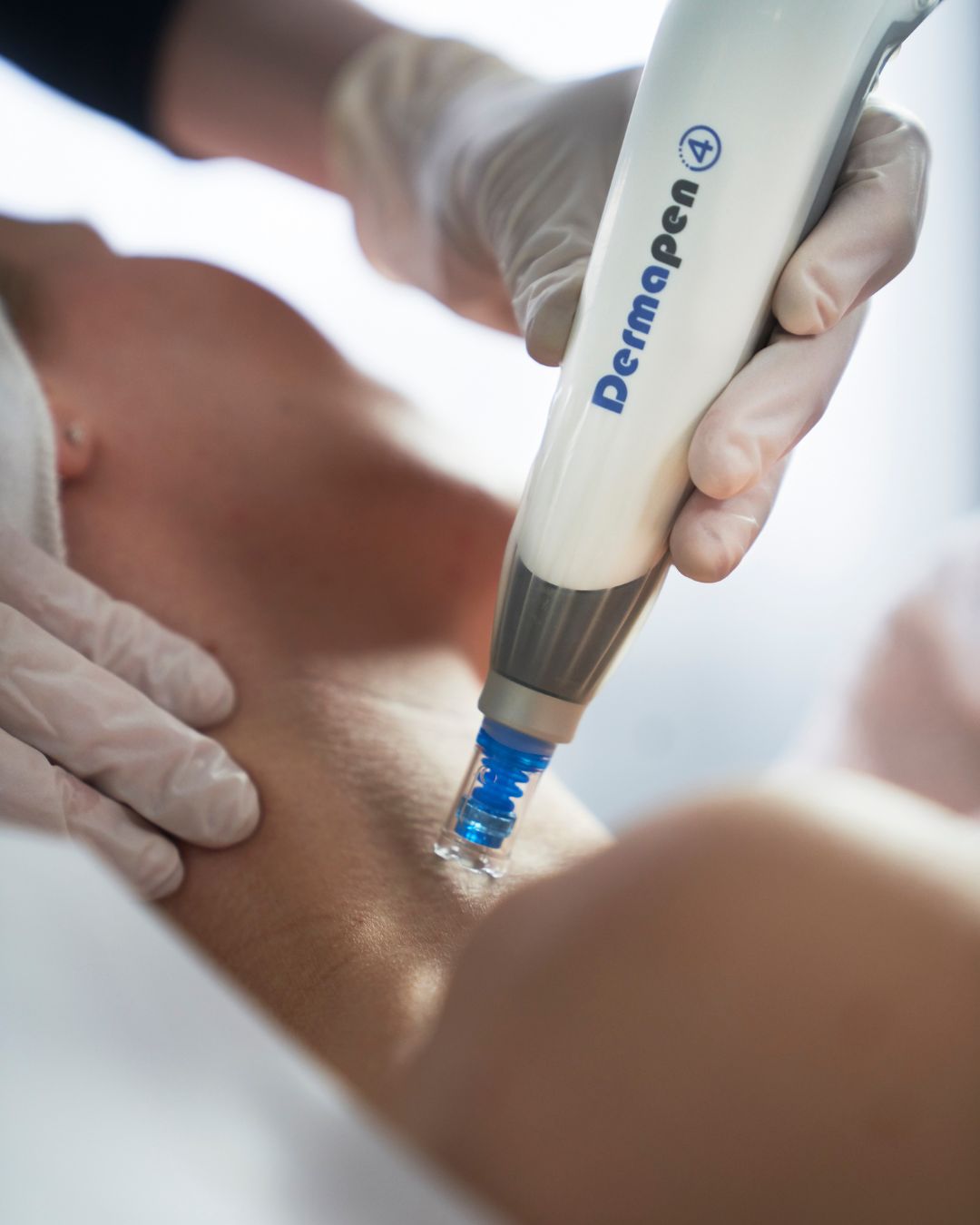 Dermapen